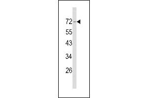 Western blot analysis of Merlin Antibody (N-term) (ABIN390756 and ABIN2841014) in NCI- cell line lysates (35 μg/lane). (Merlin anticorps  (N-Term))