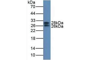 Detection of IGFBP7 in Mouse Serum using Polyclonal Antibody to Insulin Like Growth Factor Binding Protein 7 (IGFBP7) (IGFBP7 anticorps  (AA 88-281))