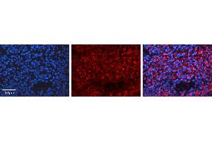Rabbit Anti-BRCA1 Antibody Catalog Number: ARP30434_P050 Formalin Fixed Paraffin Embedded Tissue: Human Lymph Node Tissue Observed Staining: Cytoplasm Primary Antibody Concentration: 1:100 Other Working Concentrations: N/A Secondary Antibody: Donkey anti-Rabbit-Cy3 Secondary Antibody Concentration: 1:200 Magnification: 20X Exposure Time: 0.
