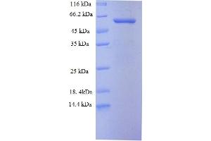 SDS-PAGE (SDS) image for Toll-Like Receptor 7 (TLR7) (AA 27-348), (partial) protein (GST tag) (ABIN5710504)