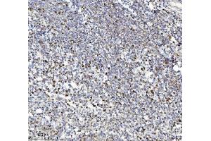 IHC analysis of MCM7 using anti-MCM7 antibody (ABIN7601968). (MCM7 anticorps  (AA 526-719))