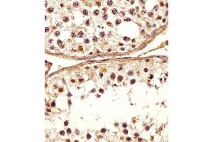 Immunohistochemical analysis of paraffin-embedded H. (DEFB107A anticorps  (C-Term))