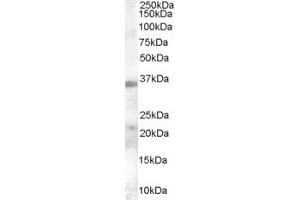 Western Blotting (WB) image for anti-Calcium Channel, Voltage-Dependent, alpha 2/delta Subunit 4 (CACNA2D4) (Middle Region) antibody (ABIN2790200) (CACNA2D4 anticorps  (Middle Region))