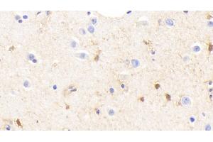 Detection of GS in Human Cerebrum Tissue using Polyclonal Antibody to Glutamine synthetase (GS)