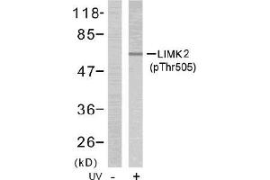 Image no. 1 for anti-LIM Domain Kinase 2 (LIMK2) (pThr505) antibody (ABIN196833) (LIMK2 anticorps  (pThr505))