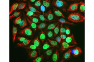 c-Fos staining in HeLa cells treated with 20% FBS for 2 hours following serum– starvation for 36 hours (green) using ABIN1842235, c-Fos localizes in nucleus in the stimulated HeLa cells.