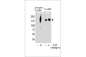 Western blot analysis of extracts from A431 cells,untreated or treated with EGF,100 ng/mL , using phospho-ERBB2-(left) or ERBB2 Antibody (right) (ErbB2/Her2 anticorps  (pTyr1248))