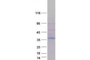 Validation with Western Blot