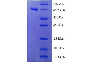 SDS-PAGE (SDS) image for Isocitrate Dehydrogenase 3 (NAD+) beta (IDH3B) (AA 35-385) protein (GST tag) (ABIN5709699)