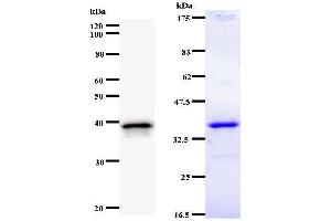 Left: UBP1 staining. (UBP1 anticorps)
