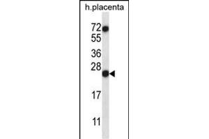 RNASE8 Antibody (C-term) (ABIN657386 and ABIN2846428) western blot analysis in human placenta tissue lysates (35 μg/lane). (RNASE8 anticorps  (C-Term))