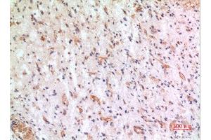 Immunohistochemistry (IHC) analysis of paraffin-embedded Human Brain, antibody was diluted at 1:100. (CX3CL1 anticorps  (Internal Region))