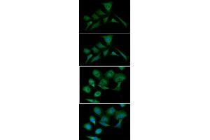ICC/IF analysis of PKM2 in HeLa cells line, stained with DAPI (Blue) for nucleus staining and monoclonal anti-human PKM2 antibody (1:100) with goat anti-mouse IgG-Alexa fluor 488 conjugate (Green). (PKM anticorps  (AA 1-531))