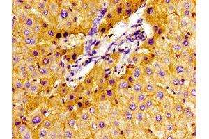 Immunohistochemistry of paraffin-embedded human liver tissue using ABIN7170131 at dilution of 1:100
