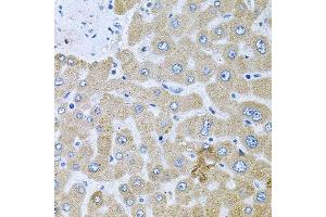 Immunohistochemistry of paraffin-embedded human liver injury using POMGNT1 antibody.