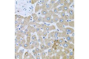 Immunohistochemistry of paraffin-embedded human liver injury using POMGNT1 antibody. (POMGNT1 anticorps  (AA 411-660))
