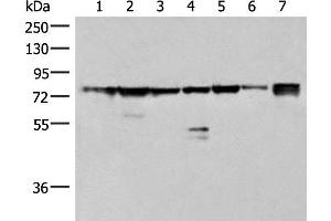 Western blot analysis of 231 K562 TM4 cell Mouse kidney tissue Mouse liver tissue Mouse brain tissue Hela cell lysates using THNSL1 Polyclonal Antibody at dilution of 1:500 (THNSL1 anticorps)