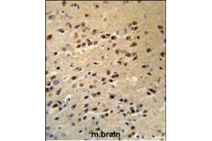 ALS2 Antibody (C-term) (R) IHC analysis in formalin fixed and paraffin embedded human brain tissue followed by peroxidase conjugation of the secondary antibody and DAB staining. (ALS2 anticorps  (C-Term))