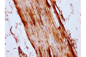 IHC image of ABIN7158674 diluted at 1:300 and staining in paraffin-embedded human skeletal muscle tissue performed on a Leica BondTM system. (LYRM4 anticorps  (AA 1-91))