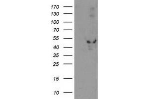 Western Blotting (WB) image for anti-Eukaryotic Translation Initiation Factor 2B, Subunit 3 Gamma, 58kDa (EIF2B3) antibody (ABIN1497968)