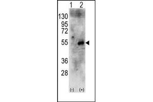 Image no. 1 for anti-Ribosomal Protein S6 Kinase, 70kDa, Polypeptide 2 (RPS6KB2) (Middle Region) antibody (ABIN360434) (RPS6KB2 anticorps  (Middle Region))