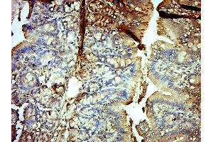 Paraformaldehyde-fixed, paraffin embedded (Rat colon); Antigen retrieval by boiling in sodium citrate buffer (pH6.