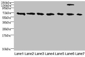 Western blot All lanes: TRPM2 antibody at 3 μg/mL Lane 1: HepG2 whole cell lysate Lane 2: Mouse brain tissue Lane 3: A549 whole cell lysate Lane 4: K562 whole cell lysate Lane 5: Mouse kidney tissue Lane 6: Human placenta tissue Lane 7: Mouse spleen tissue Secondary Goat polyclonal to rabbit IgG at 1/10000 dilution Predicted band size: 172, 166, 96 kDa Observed band size: 70 kDa