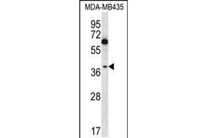 Western blot analysis in MDA-MB435 cell line lysates (35ug/lane). (NFKBIL1 anticorps  (C-Term))