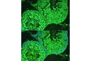 Immunofluorescence analysis of rat testis cells using  antibody  at dilution of 1:100.
