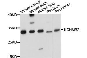 Western blot analysis of extract of various cells, using KCNMB2 antibody. (KCNMB2 anticorps)
