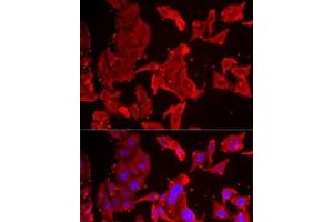 Immunofluorescence analysis of MCF7 cells using SMPX Polyclonal Antibody (SMPX anticorps)