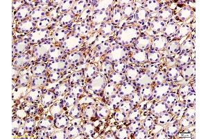 Formalin-fixed and paraffin embedded rabbit kidney tissue labeled with Anti-VEGF Polyclonal Antibody, Unconjugated (ABIN674829) followed by conjugation to the secondary antibody and DAB staining (VEGF anticorps)