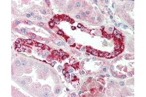Anti-PRK / PLK3 antibody IHC staining of human kidney. (PLK3 anticorps  (AA 320-333))
