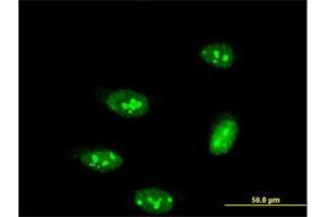 Immunofluorescence of monoclonal antibody to TP53RK on HeLa cell. (TP53RK anticorps  (AA 154-253))