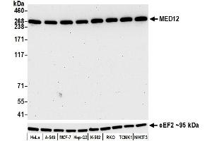 Western Blotting (WB) image for anti-Mediator Complex Subunit 12 (MED12) (AA 2127-2177) antibody (ABIN7453977)