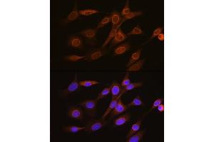 Immunofluorescence analysis of NIH-3T3 cells using RanG Rabbit mAb (ABIN7269846) at dilution of 1:100 (40x lens).
