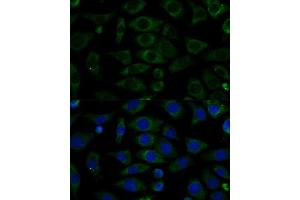 Immunofluorescence analysis of L929 cells using NDUFB7 Polyclonal Antibody (ABIN6132403, ABIN6144480, ABIN6144481 and ABIN6217781) at dilution of 1:100 (40x lens).