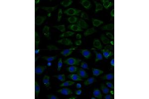 Immunofluorescence analysis of L929 cells using NDUFB7 Polyclonal Antibody (ABIN6132403, ABIN6144480, ABIN6144481 and ABIN6217781) at dilution of 1:100 (40x lens). (NDUFB7 anticorps  (AA 1-137))