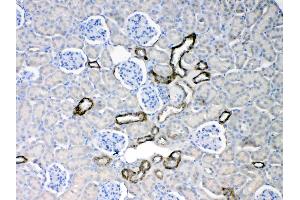 Cytokeratin 18 was detected in paraffin-embedded sections of mouse kidney tissues using rabbit anti- Cytokeratin 18 Antigen Affinity purified polyclonal antibody (Catalog # ) at 1 µg/mL.