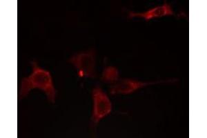 ABIN6275754 staining NIH-3T3 cells by IF/ICC. (GNE anticorps)