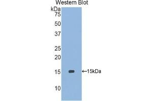 Detection of Recombinant SEPX1, Human using Polyclonal Antibody to Selenoprotein X1 (SEPX1)
