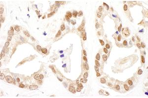 Immunohistochemistry (IHC) image for anti-Fanconi Anemia, Complementation Group D2 (FANCD2) (AA 1401-1451) antibody (ABIN7453818)