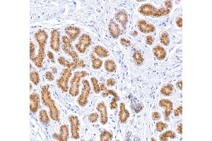 Immunohistochemistry (IHC) image for anti-Signal Transducer and Activator of Transcription 5A (STAT5A) (AA 744-794) antibody (ABIN7454017) (Recombinant STAT5A anticorps  (AA 744-794))