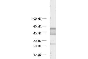 dilution: 1 : 1000, sample: unboiled rat cerebellum lysate (GABRA6 anticorps  (AA 20-30))