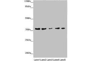 Western blot All lanes: MTHFD2 antibody at 4. (MTHFD2 anticorps  (AA 40-250))