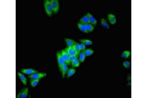Immunofluorescent analysis of HepG2 cells using ABIN7149659 at dilution of 1:100 and Alexa Fluor 488-congugated AffiniPure Goat Anti-Rabbit IgG(H+L) (ECH1 anticorps  (AA 36-135))
