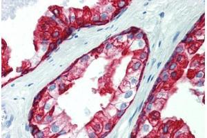 Prostate, Human: Formalin-Fixed, Paraffin-Embedded (FFPE) (Cytokeratin 19 anticorps  (C-Term))