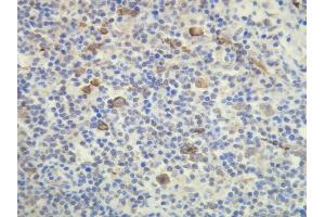 Immunohistochemistry (IHC) image for anti-Fucosyltransferase 4 (Alpha (1,3) Fucosyltransferase, Myeloid-Specific) (FUT4) (AA 28-49), (N-Term) antibody (ABIN7598870)