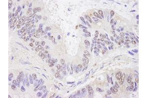 Immunohistochemistry (IHC) image for anti-BCL2-Associated Transcription Factor 1 (BCLAF1) (AA 150-200) antibody (ABIN7448448) (BCLAF1 anticorps  (AA 150-200))