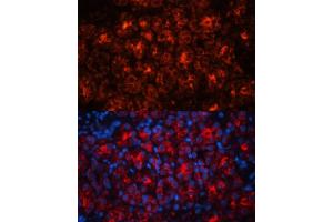 Immunofluorescence analysis of rat kidney using Lipocalin-2/NGAL antibody (ABIN3017525, ABIN3017526, ABIN3017527 and ABIN6220135) at dilution of 1:100.